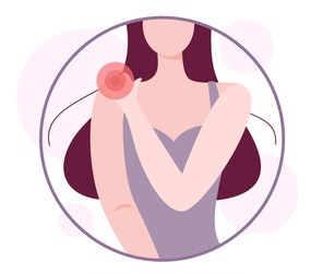 Ilustração colorida de uma mulher segurando o ombro, com um círculo vermelho indicando a área de dor e tensão no músculo trapézio.